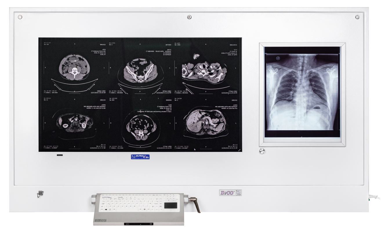 DICO - stacje na salę operacyjną