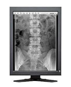 Monitor monochromatyczny Eizo RadiForce GS220 21,3