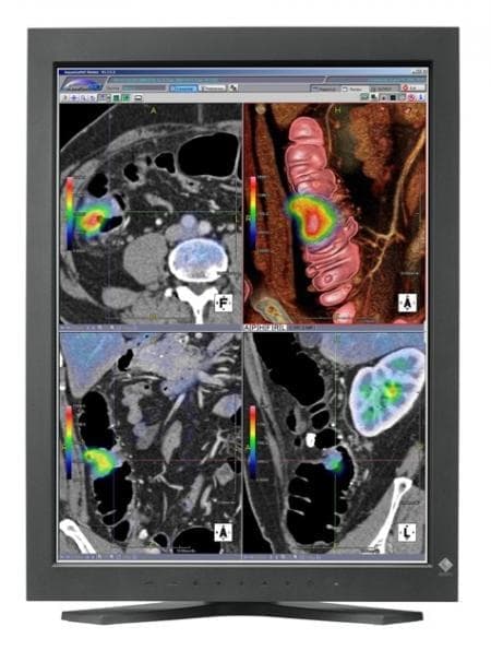 Monitor kolorowy  Eizo RadiForcee RX220 21
