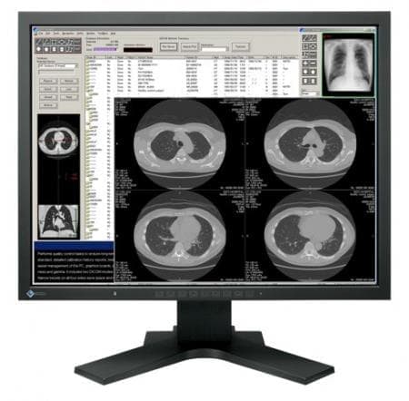 Monitor kliniczny FlexScan MX 216 21,3