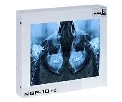 Negatoskop CEFALOM 01