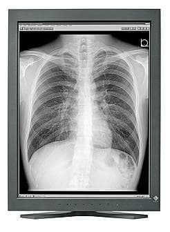 Monitor monochromatyczny Eizo RadiForce GX320 21,3