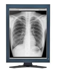 Monitor monochromatyczny Eizo RadiForce GS52121,3