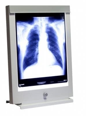 Negatoskop LED NGP 11 