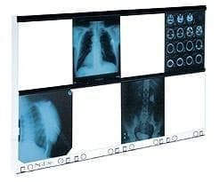 Negatoskop NGP-80 hf - ośmioklatkowy