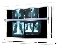 Negatoskop żaluzjowy do mammografii NGP-41 mZU