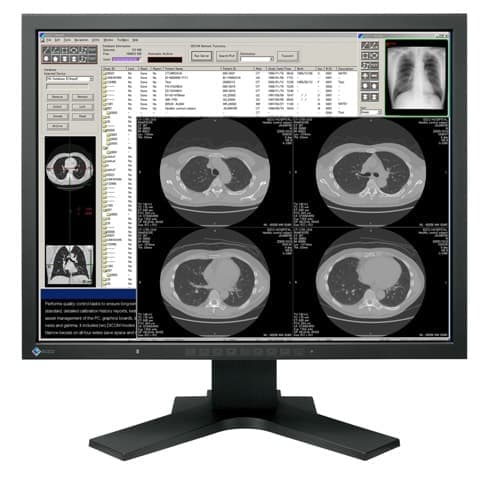 Monitory kliniczne podglądowe 