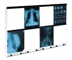Negatoskopy z podziałem na klatki